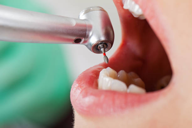 Best Emergency Dentist for Knocked-Out Tooth in Green Tree, PA